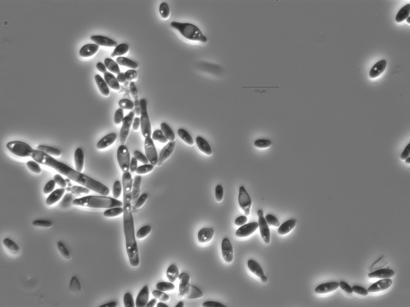H. valbyensis cells grown in YM media.