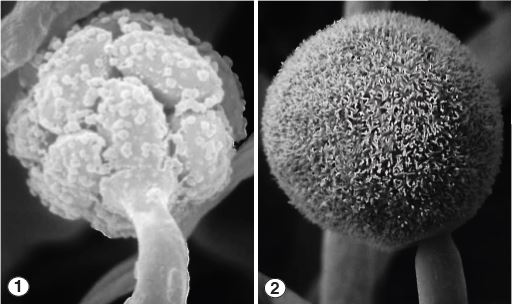 Few-spored sporangiola (Fig 1) and multispored sporangia (Fig 2) of Helicostylum pulchrum. Images by Kerry O'Donnell.