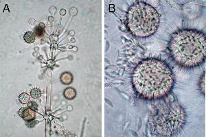 Hesseltinella sporophore apex (a)  and sporangiolum (b). Photo credit: Gerald Benny, Department of Plant Pathology, University of Florida, Gainesville, Florida 
