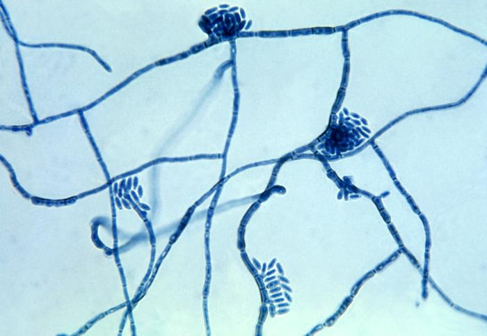 Micrograph of the fungus Hortaea werneckii, which is the causative agent of tinea nigra (photo taken in 1964). Image by Dr. Lucille K. Georg (CDC). https://en.wikipedia.org/wiki/Hortaea_werneckii