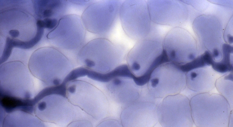 Hyphae of Hyaloperonospora arabidopsidis growing within the leaf of a compatible Arabidopsis thaliana observed by bright-field microscopy.