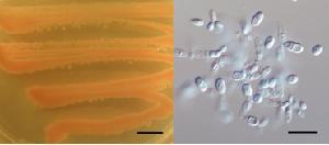 Jaminaea rosea MCA5214 culture on potato dextrose agar (left) and pseudohyphae formation in yeast-malt broth (right)
