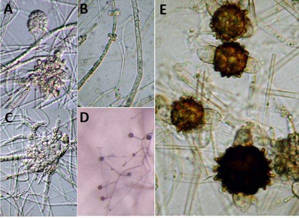 Fig. A. Lentamyces parricidus (Benny s116) sporangium and a large
multilobed gall where it is infecting the host Absidia. Fig. B.
Lentamyces parricidus (Benny s116) showing an early stage of gall
formation where it is infecting the host Absidia. Fig. C.
Lentamyces parricidus (Benny s116) showing a very large multilobed
gall where it is infecting the host Absidia. Fig. D. Lentamyces
parricidus (Benny s116) (fungus with the finer hyphae) parasitizing
a host fungus in the genus Absidia (fungus with thicker hyaphe).
Fig. E. Lentamyces parricidus (Benny s116) showing several
zygospores and the small hemi-sphaerical suspensors. Images by
Gerald Benny available on <a
href="http://zygomycetes.org/index.php?id=158">Zygomycetes.org
Lentamyces page.</a>
