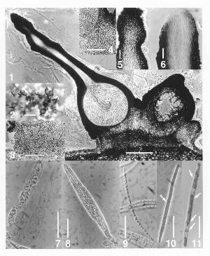 Morphological features of Lollipopaia minuta. Figure 1. Vertical section of fruiting body. Figure 2. Cluster of fruiting bodies. Figures 3-6. Details of fruiting body morphology. Figure 7. Paraphysis (right) and immature asci (left). Figure 8. Mature ascus. Figures 9-11. Ascospores. Image credit: Inderbitzin & Berbee (2001), reproduced with permission from NRC Research Press.