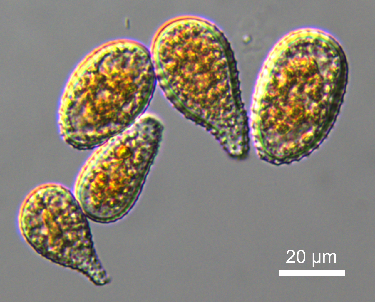 Urediniospores of Melampsora x columbiana. Photo by Edward Barge.