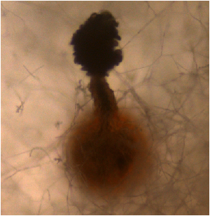 Melanospora tiffanyae perithecium with pigmented ascospores accumulated at the ostiole by Derek Johnson