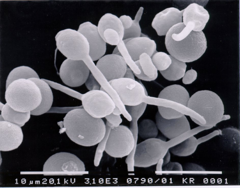 Scanning electron micrograph of asci of Metschnikowia koreensis