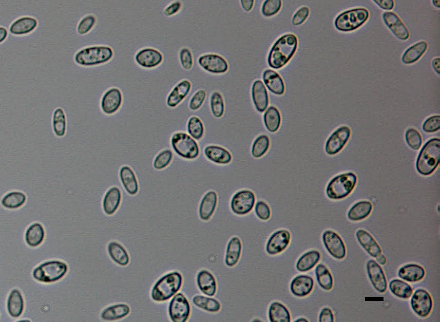 Metschnikowia reukaufii budding cells and chlamydospores