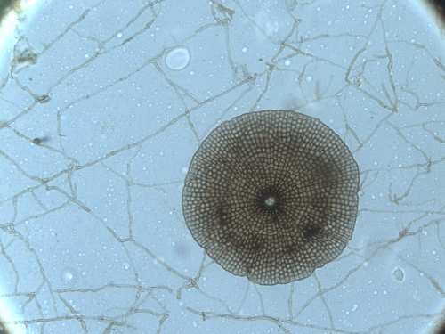 Thyrothecium of Microthyrium microscopicum