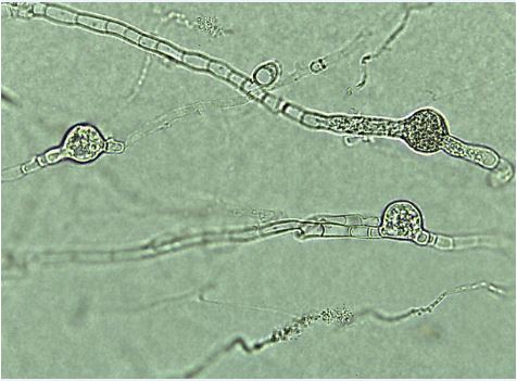 Figure 2. Chlamydospores within Mortierella elongata NVP64 mycelium.