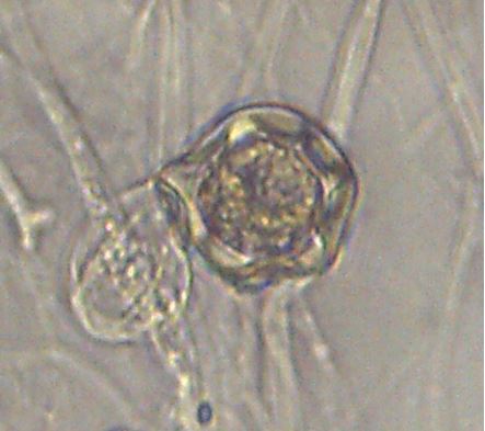 Figure 3. Zygospore produced via successful mating of Mortierella elongata NVP64. Images courtesy of Abigail Bryson and Natalie Vande Pol.