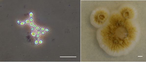 Budding yeast cells (left) and colony morphology (right) of Moniliella sp. MCA3643. Bars = 20 microns (left) and 2.5 mm (right). Photo courtesy: Teeratas Kijpornyongpan (left) and M. Catherine Aime (right).