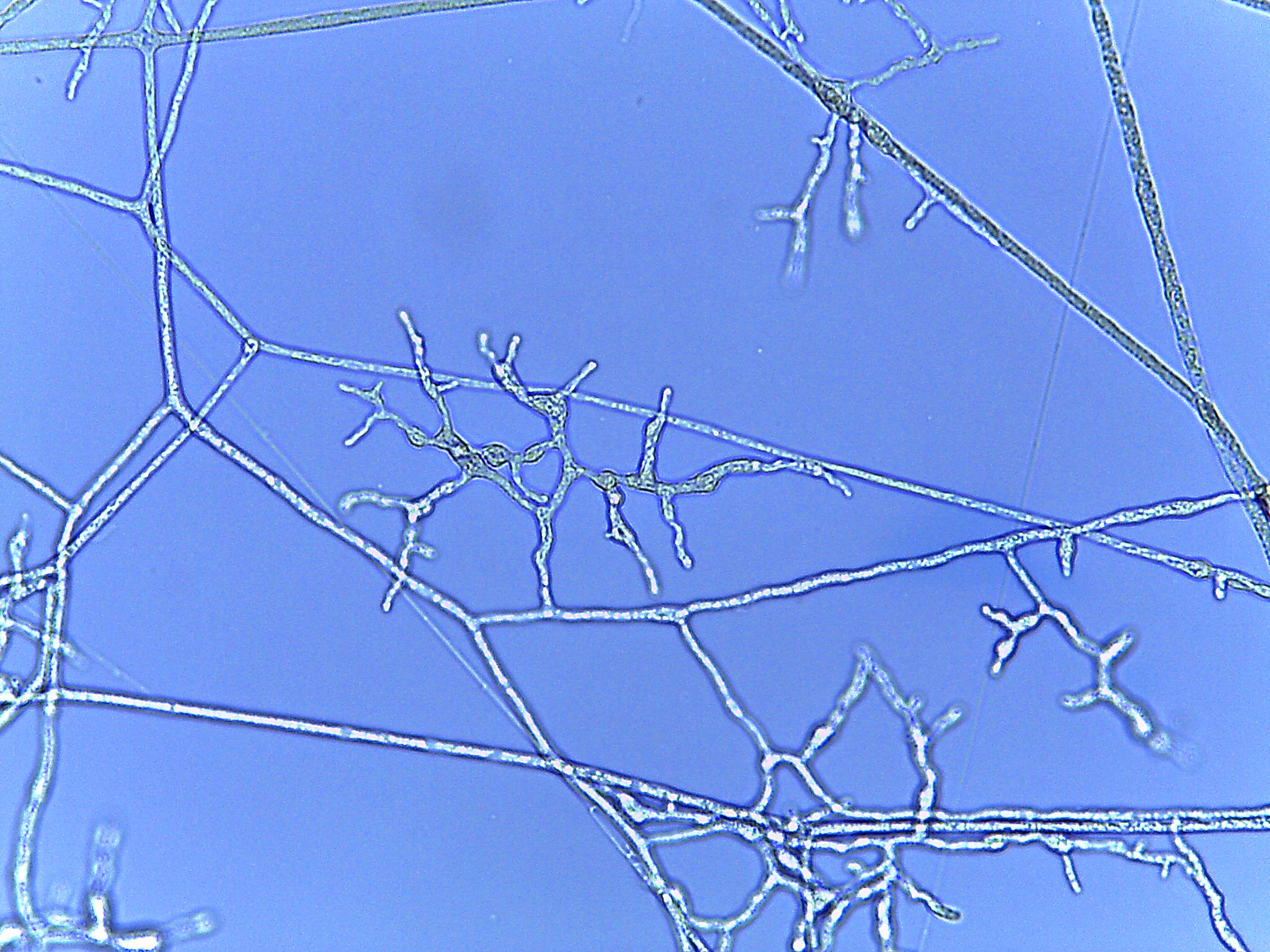 Figure 2. AD185 and related lineages of Mortierellaceae produce terminal dendritic structures on axillary branches of hyphae. The structures mature into branched, spherical chlamydospores. Image courtesy of Julian Liber.