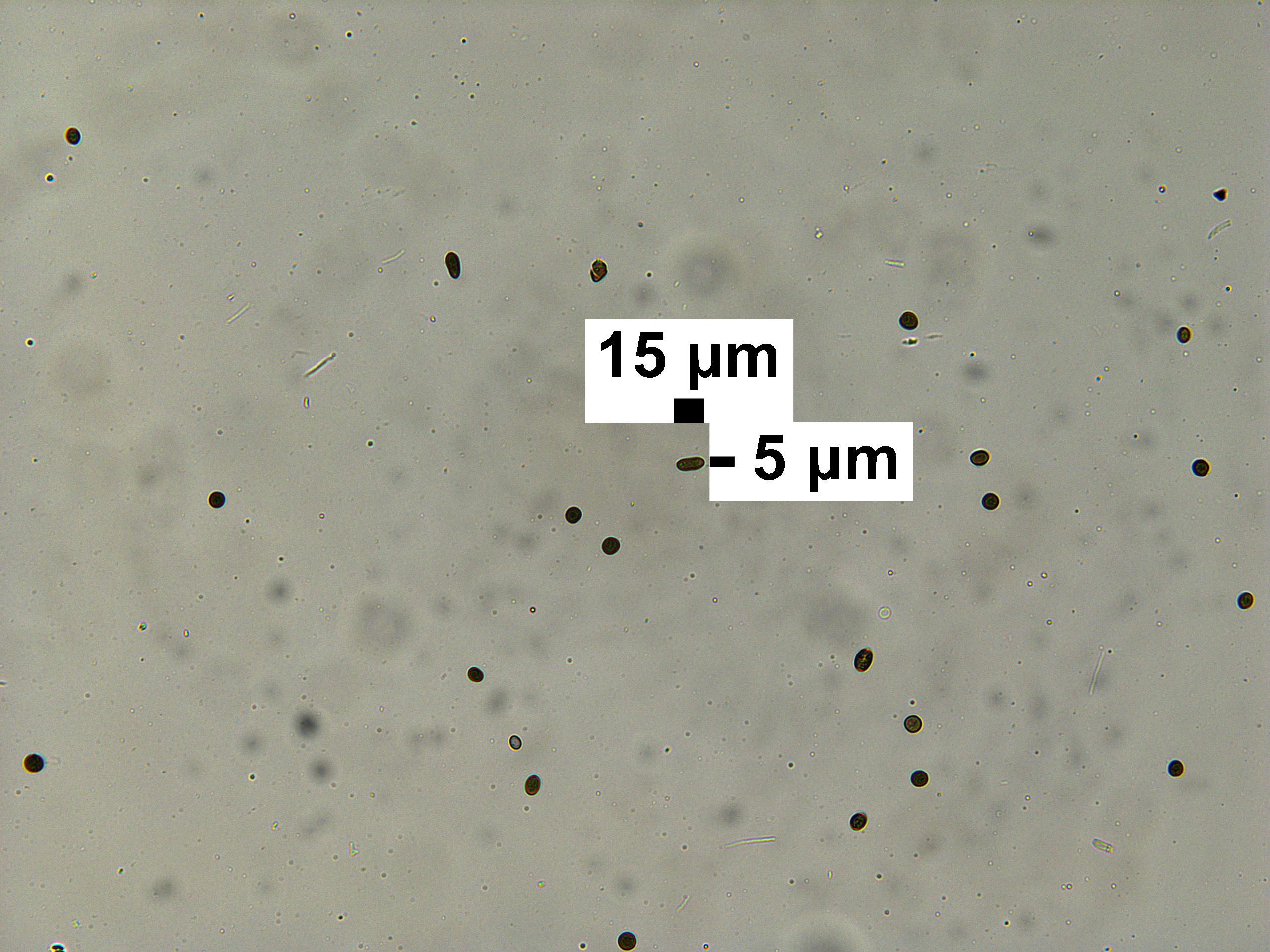 Spore diameter of Linnemannia elongata BESC-56, a related species. Image by Kyle Mondron.