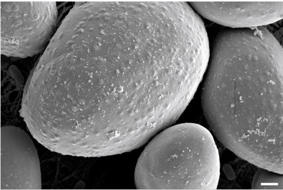 Scanning electron microscope image of Mucor lusitanicus sporangiophores. White bar represents 1 um (courtesy of Carlos Lax).