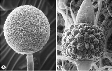 Fig A) Mucor mucedo multispored sporangia borne terminally on aerial sporangiophores. Fig B) M. mucedo zygospore held between opposed suspensors. Images by Kerry O'Donnell.