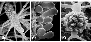 Globose, unispored sporangium (Fig. 1), cylindrical unispored sporangium (Fig. 2), and zygospores between opposed suspensors (Fig. 3) of Mycotypha africana. Images provided by Kerry O'Donnell