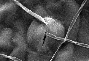 Photo of Pseudocercospora (Mycosphaerella) fijiensis v2.0