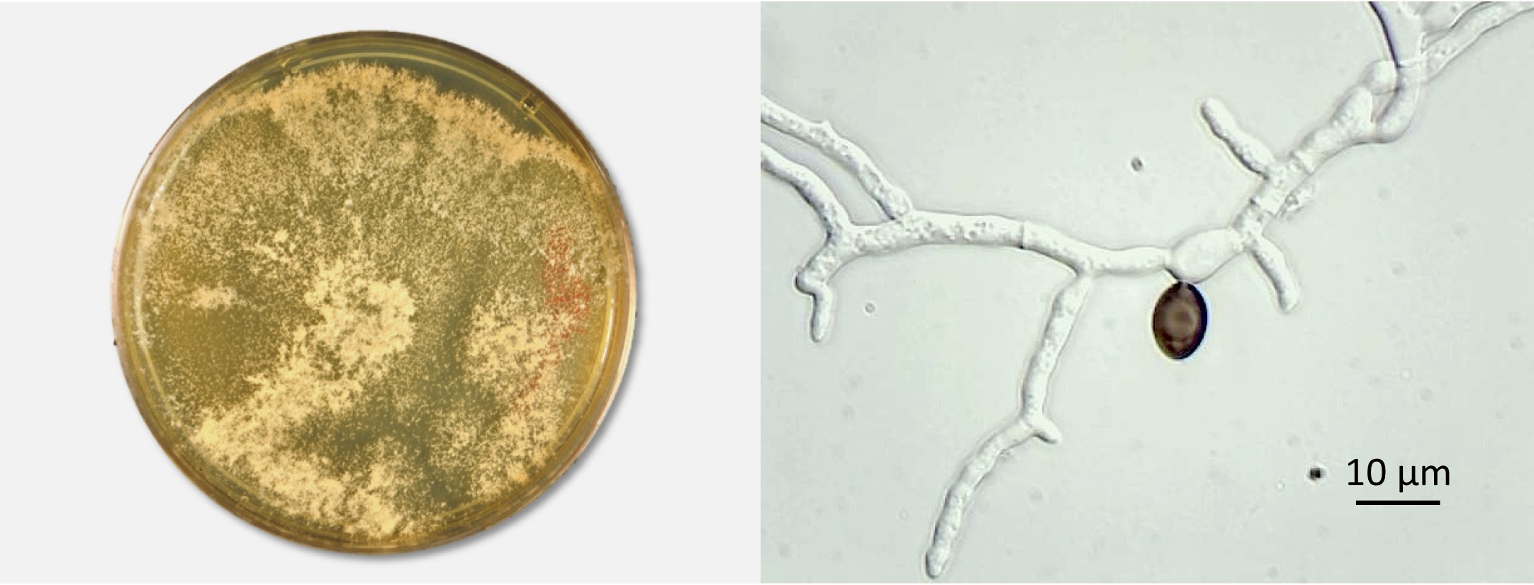 Conidiating colony on MEA and germinating ascopore. Photos by Don Natvig and Miriam Hutchinson
