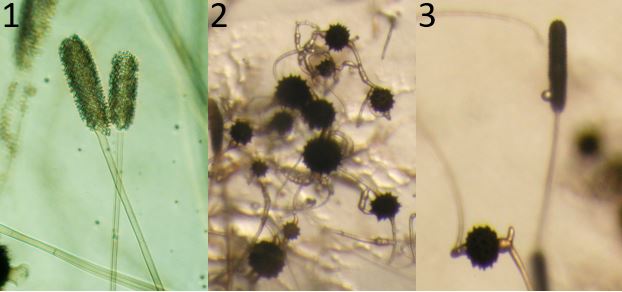 Figure 1) Mycotypha indica (strain 10x3463-300). Two typical vesicles covered with sporangiola. Figure 2) Mycotypha indica (strain 11x3399Z+-300). Zygospores on the agar surface. Figure 3) Mycotypha indica (strain 10x3400 Z+vesicle-300). A zygospore and
sporophore showing a side-by-side comparison of the size differences. Images by Gerald Benny.