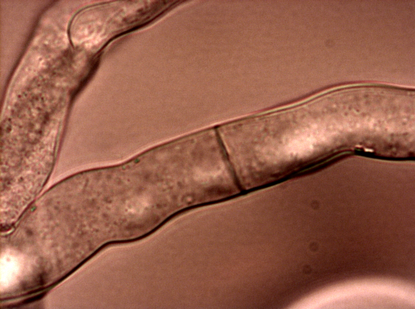 Hyphae of Neurospora crassa with septum and porus.