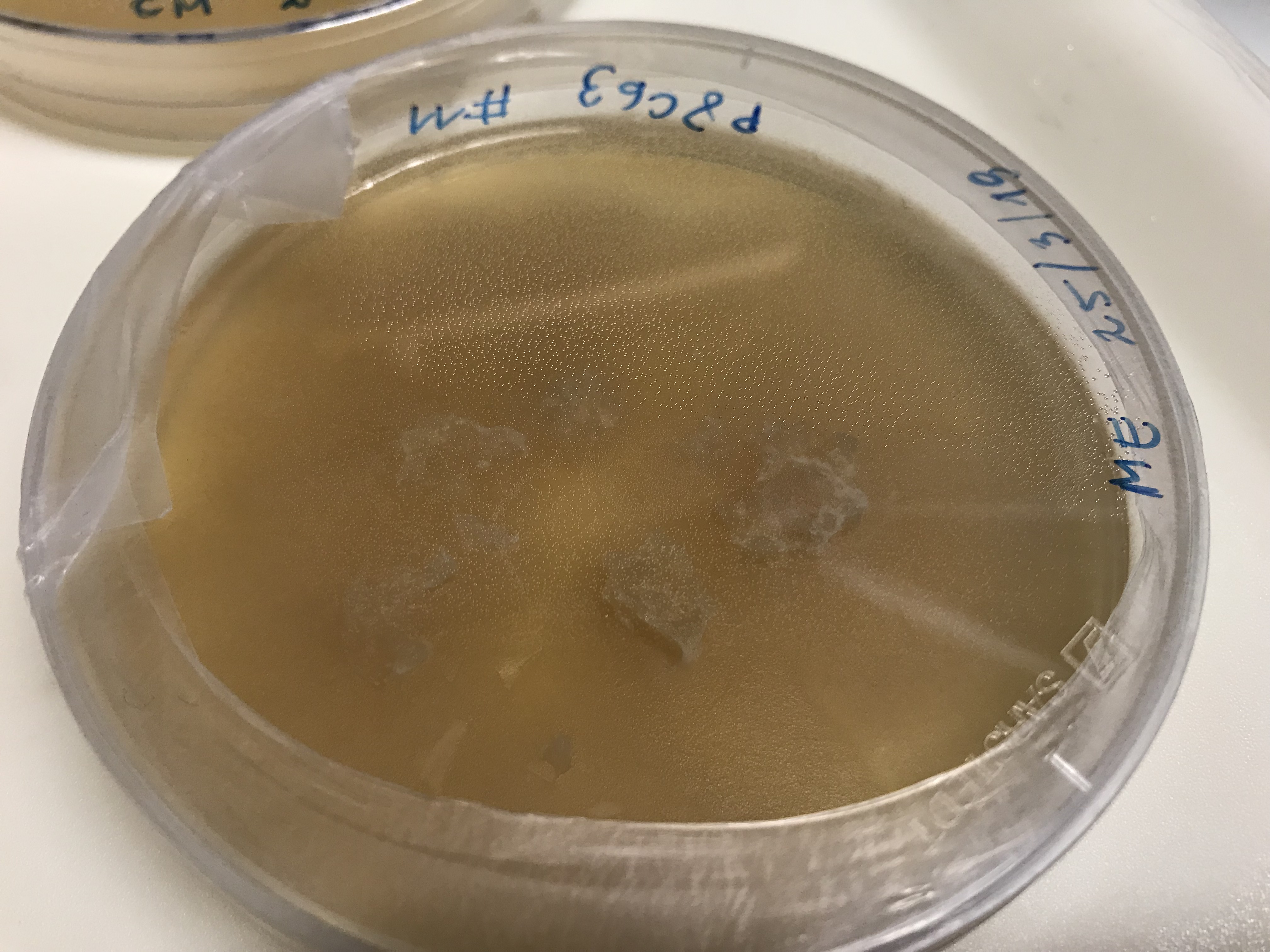 Helotiales isolate P8C63 growing in the lab.