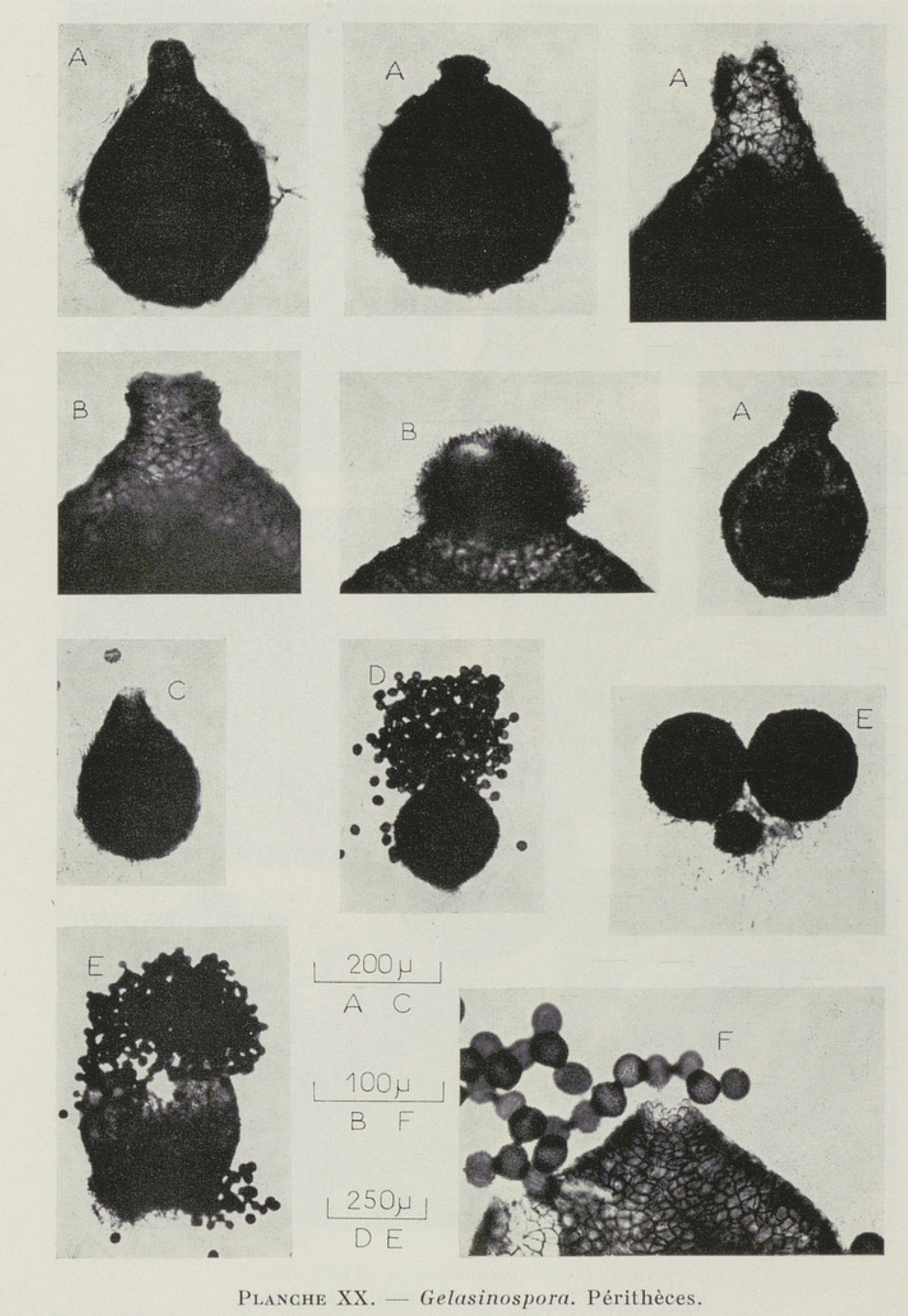 Perithecia of various Gelasinospora species
