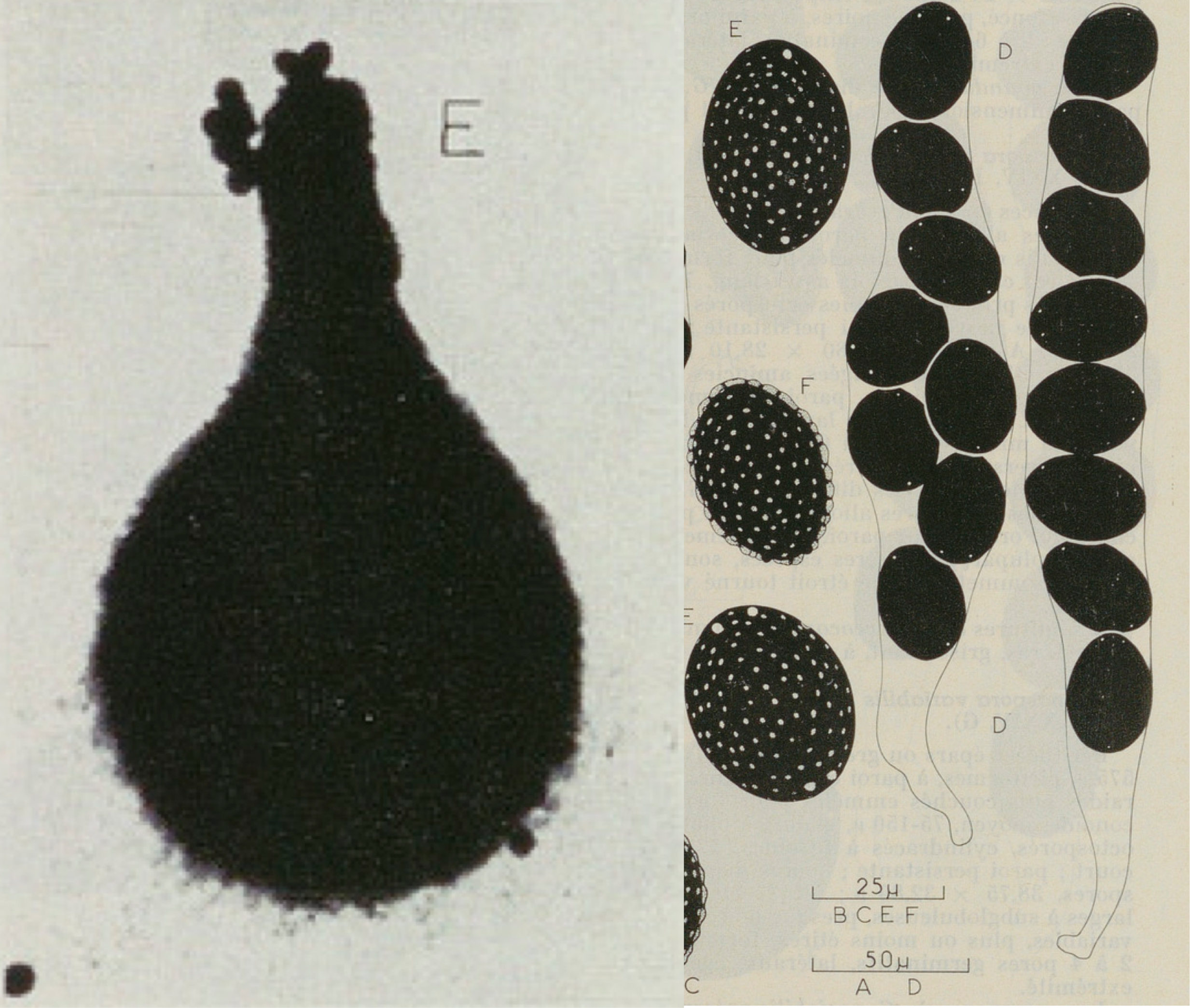 Perithecium, asci, and ascospores of Neurospora kobi.