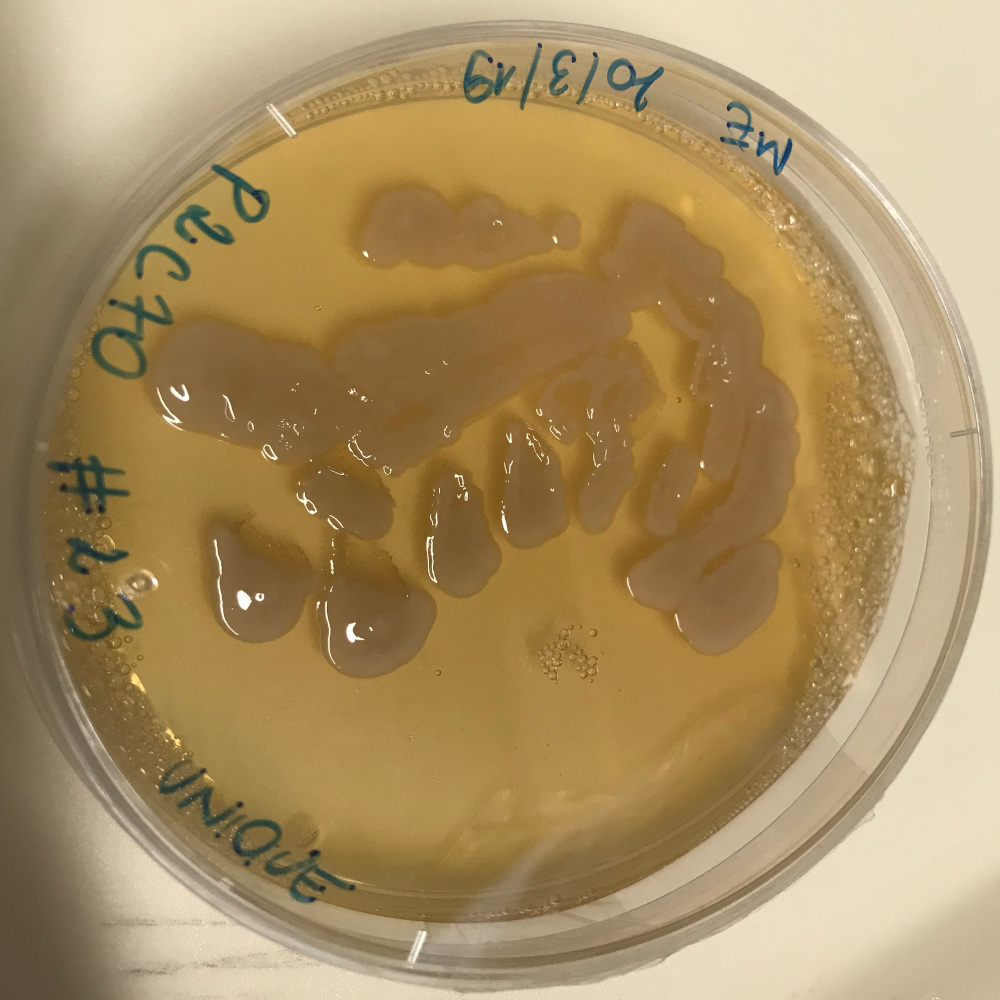 Microbotryomycetes isolate P2C70 growing in the lab.