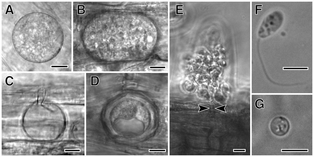 From Sekimoto et al., 2011: Olpidium bornovanus, a unicellular
fungus, is an obligate parasite of plants that reproduces with
flagellated, swimming zoospores. A-B. Vegetative unicellular thalli
in cucumber root cells. Thalli differentiate into sporangia with
zoospores, or into resting spores. C. An empty sporangium, after
zoospore release. D. A thick-walled resting spore. E. Zoospores
being released from a sporangium, showing the sporangium exit tube
(arrowheads). F. A swimming zoospore with a single posterior
flagellum. G. An encysted zoospore. Bars: A-E = 10 &mu;m; F,G = 5
&mu;m. Figures are from <a
href="https://bmcevolbiol.biomedcentral.com/articles/10.1186/1471-2148-11-331">Sekimoto et.
al., 2011</a> used under a <a
href="http://creativecommons.org/licenses/by/2.0/">Creative Commons
Attribution 2.0</a> License.