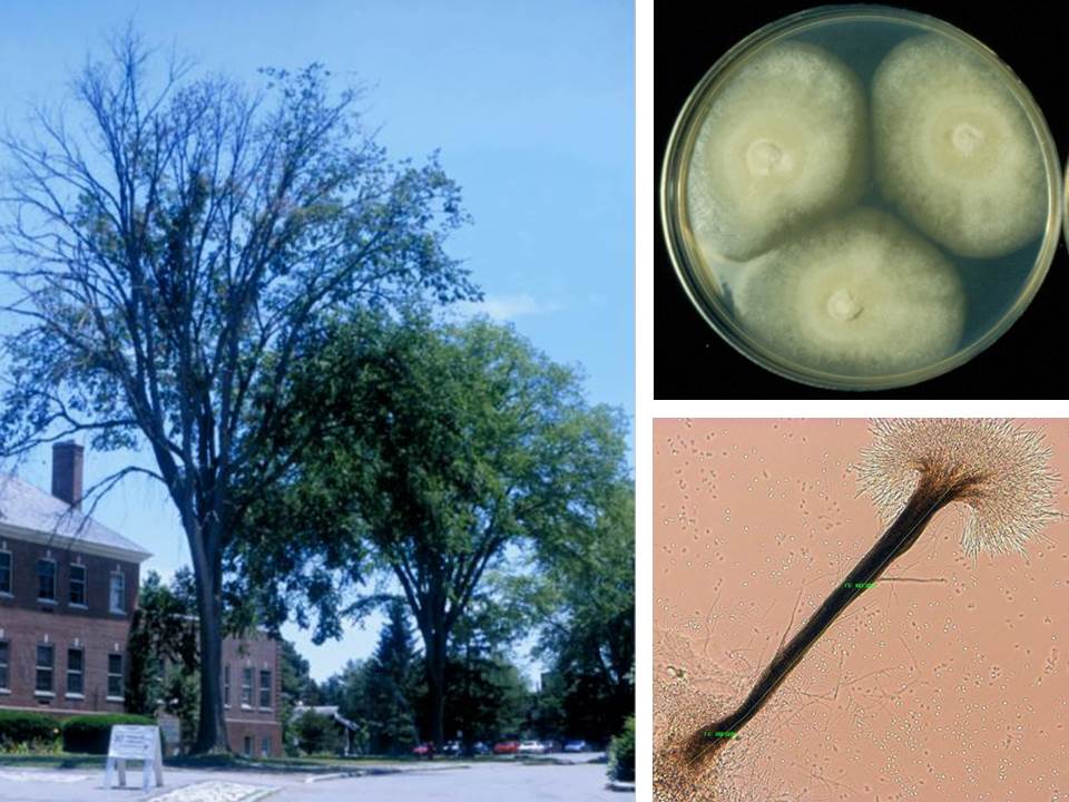 Dutch elm disease caused by Ophiostoma novo-ulmi.