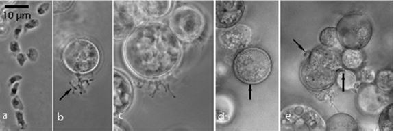 Images of Paraphysoderma strain JEL821:
a) Amoeboid spores.
b) Developing sporangium with filamentous rhizoids (arrow) in pure culture. 
c) Later stage of sporangial development.
d) Thick-walled (arrow) resting spore.
e) Early germination stage of resting spore. Note walls have curled back (arrows) and endosporangium is beginning to emerge (compare with Physoderma germination (Figs. 3, 4. Sparrow et al. 1961).
Photos by Joyce E. Longcore.