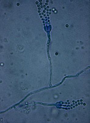 Penicillium spp. under bright field microscopy (10 x 100 magnification) with lactophenol cotton blue stain. Photo credit: Dr. Sahay. CC BY-SA 3.0 via Wikimedia Commons
