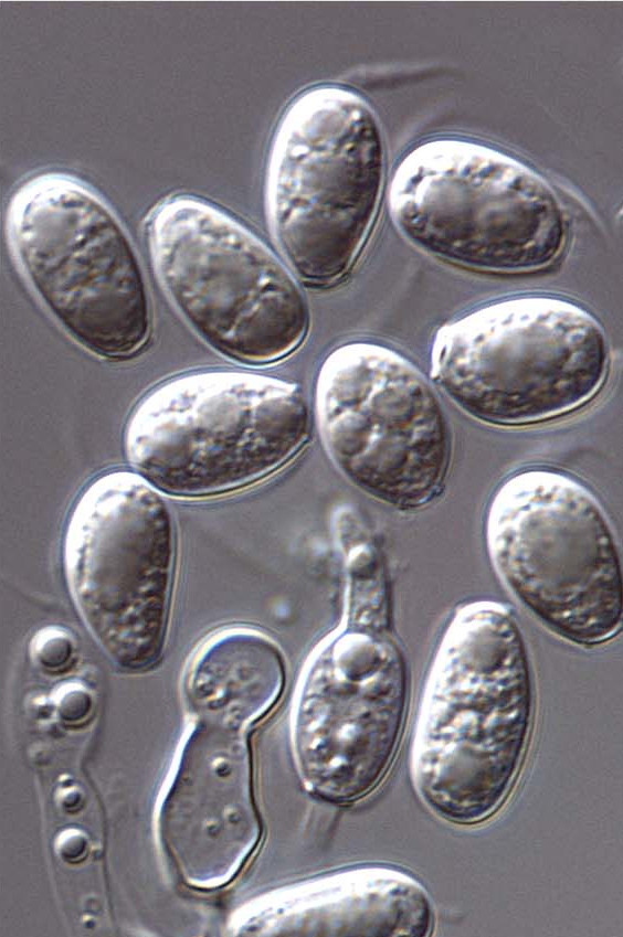 Conidia with mucoid sheath and apical mucilaginous appendage visible.