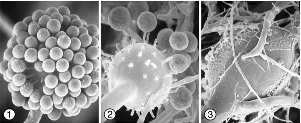 Figures 1 and 2) Globose unispored sporangiola of Phascolomyces articulosus borne terminally on slender pedicles on sporangiophore vesicles. Images by Kerry O'Donnell.