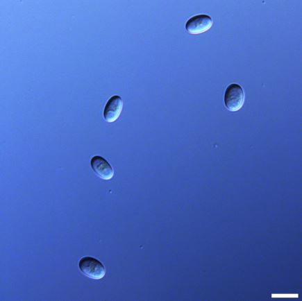 Asexual spores produced by Phycomyces blakesleeanus strain UBC21. Scale bar = 10 um. Image provided by Alexander Idnurm.