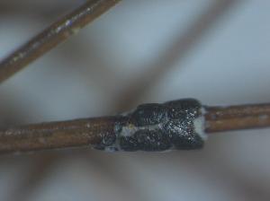 Stroma on human hair, containing locules with asci and ascospores.