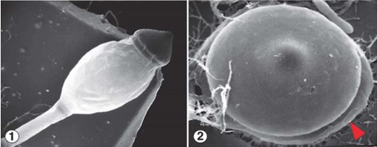 Figure 1) Hat-shaped sporangium of P. umbonatus, which sits atop a turgor-filled phototropic subsporangial vesicle. Figure 2) Discharged sporangia adhere to the surface they land on via sticky material on the sporangium undersurface (red arrow). Images by Kerry O'Donnell.