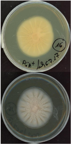 Plectosphaerella cucumerina growing in the lab.