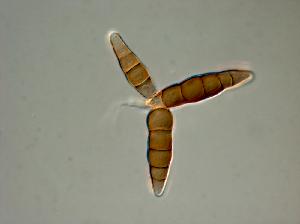 Conidium of Pleomassaria siparia.
