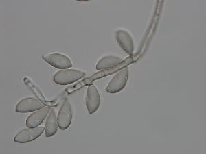 Pseudovirgaria hyperparasitica - Conidiophore and conidia