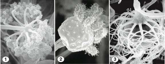 Fig 1) Globose vesicles at the apex of an erect sporangiophore. Fig 2) Numerous few-spored sporangiola, covered with capitate appendages. Fig 3) Smooth zygospores between opposed suspensors bearing branched appendages. Images by Kerry O'Donnell