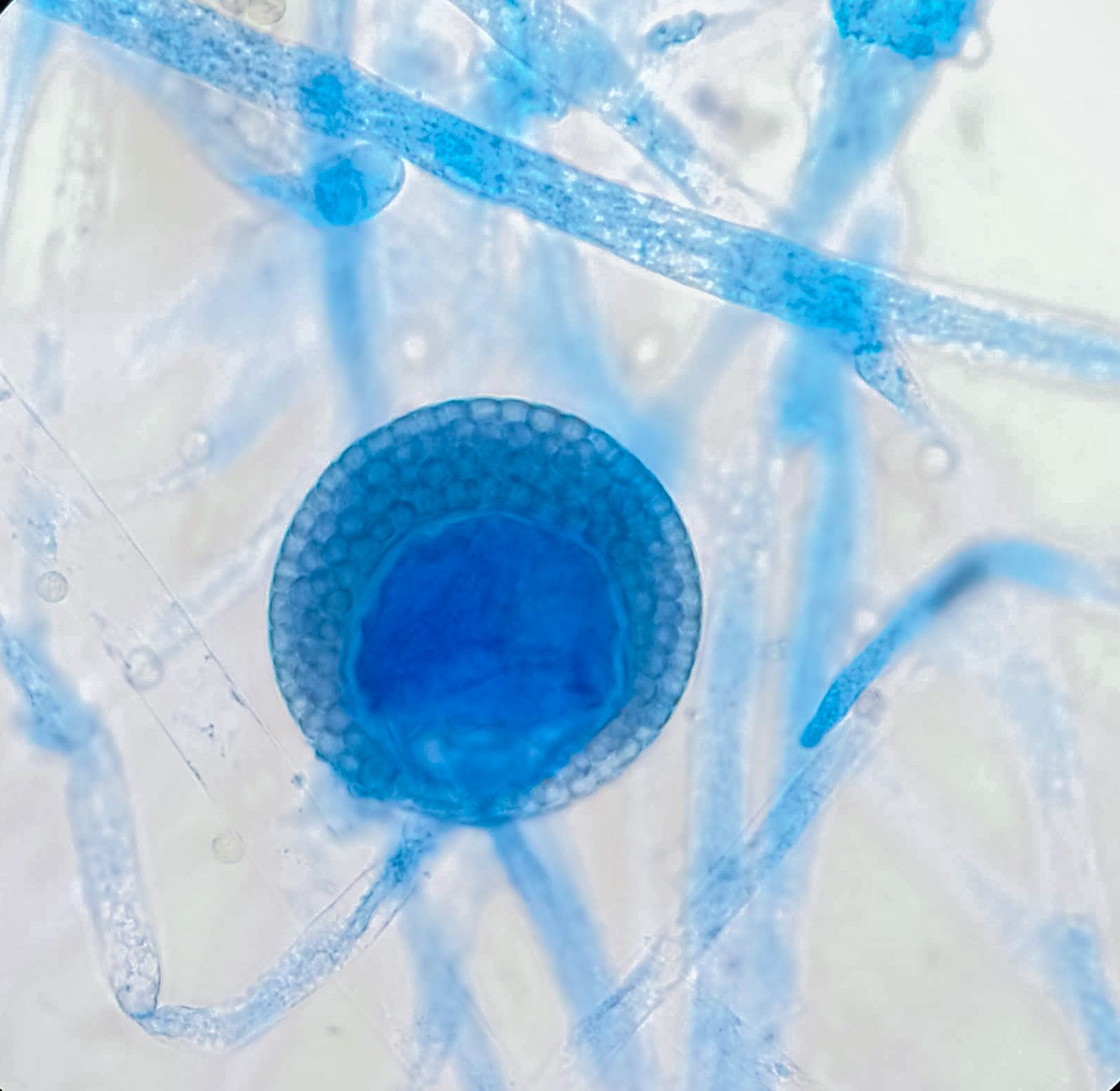 Photomicrograph of a mature Rhizopus microsporus sporangium, strain ATCC 11559, stained with lactophenol cotton blue (100x magnification). Courtesy of Antonio Tapia-Moragón and Dr. Pedro L. Valero-Guillén (University of Murcia)