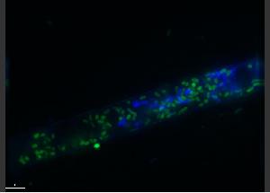 DAPI stained hypha of R. microsporus ATCC52814 harboring YFP labeled Burkholderia endosymbionts