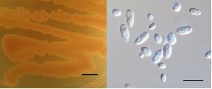 Pseudomicrostroma glucosiphilum gen et sp. nov. MCA4718 culture on potato dextrose agar (PDA) plate (left) and cell morphology from yeast-malt broth (right)