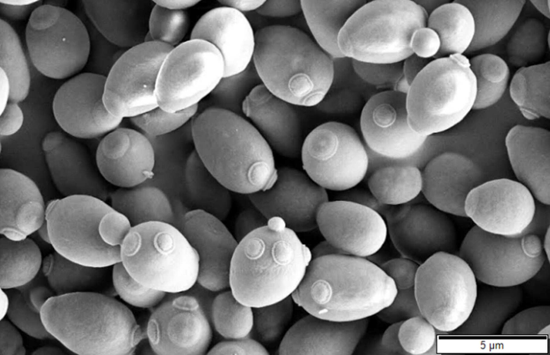 Saccharomyces cerevisiae SEM image. Image by Mogana Das Murtey and Patchamuthu Ramasamy available via <a href="https://en.wikipedia.org/wiki/Saccharomyces_cerevisiae#/media/File:Saccharomyces_cerevisiae_SEM.jpg">Wikimedia</a> under a <a href="https://creativecommons.org/licenses/by/3.0">Creative Commons 3.0 license</a>.