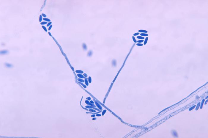 Conidia and conidiophores of a close relative of Sarocladium strictum, Acremonium falciforme. Image by the Center for Disease Control (CDC).