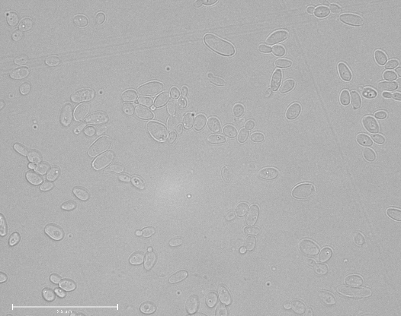 Scheffersomyces amazonensis UFMG-HMD-26.3. Image by Katharina de Oliveira Barros.