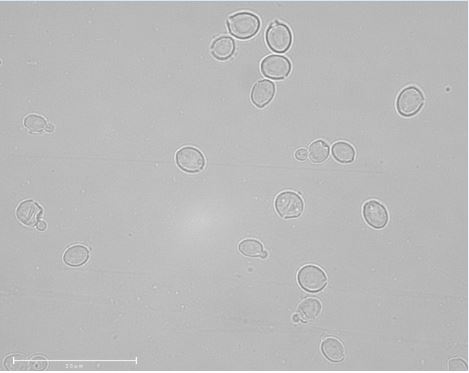 Scheffersomyces gosingicus CBS11433T. Image by Katharina de Oliveira Barros.