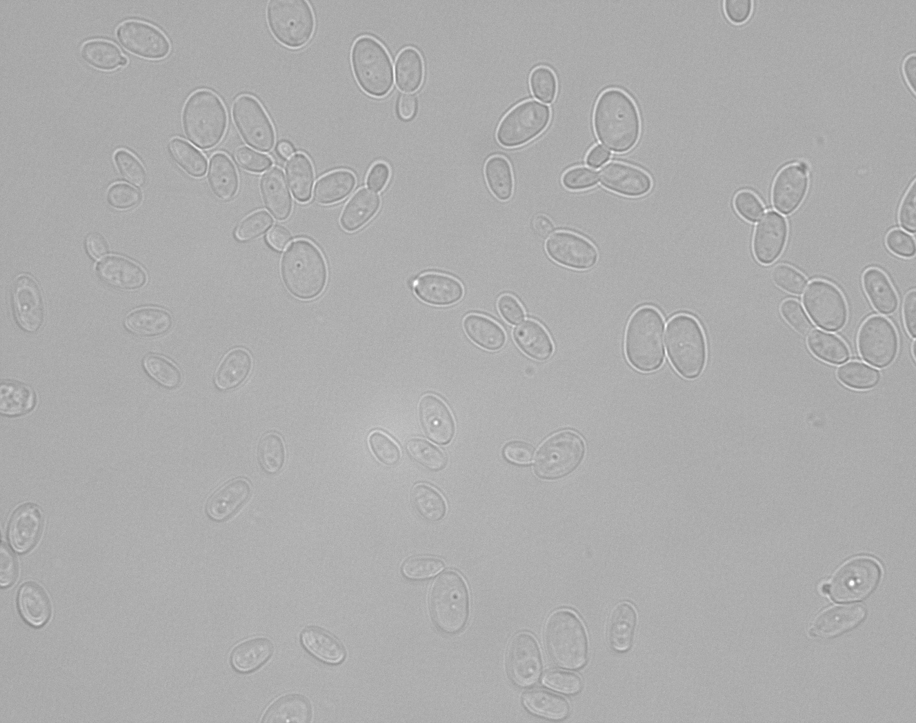Scheffersomyces illinoisensis NRRL Y-48827T. Photo credit: Katharina Barros, David Krause, Chris Hittinger